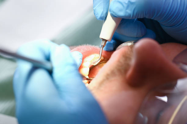 Best 24-Hour Emergency Dental Care in Bull Run Mountain Estates, VA